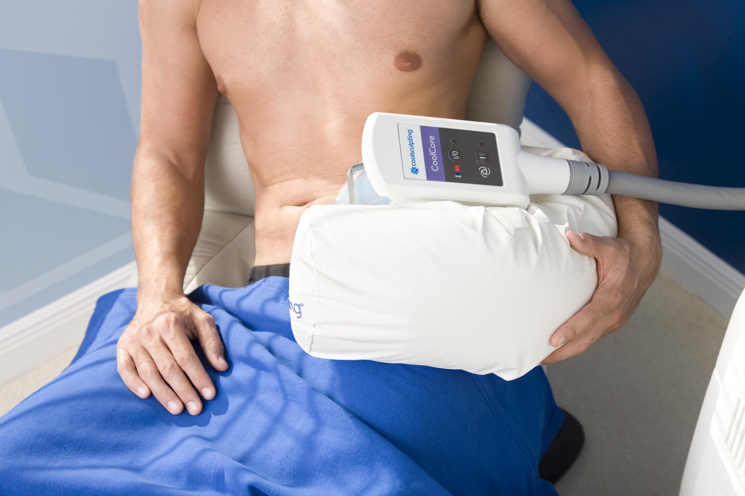 cryolipolysis coolsculpting virginia