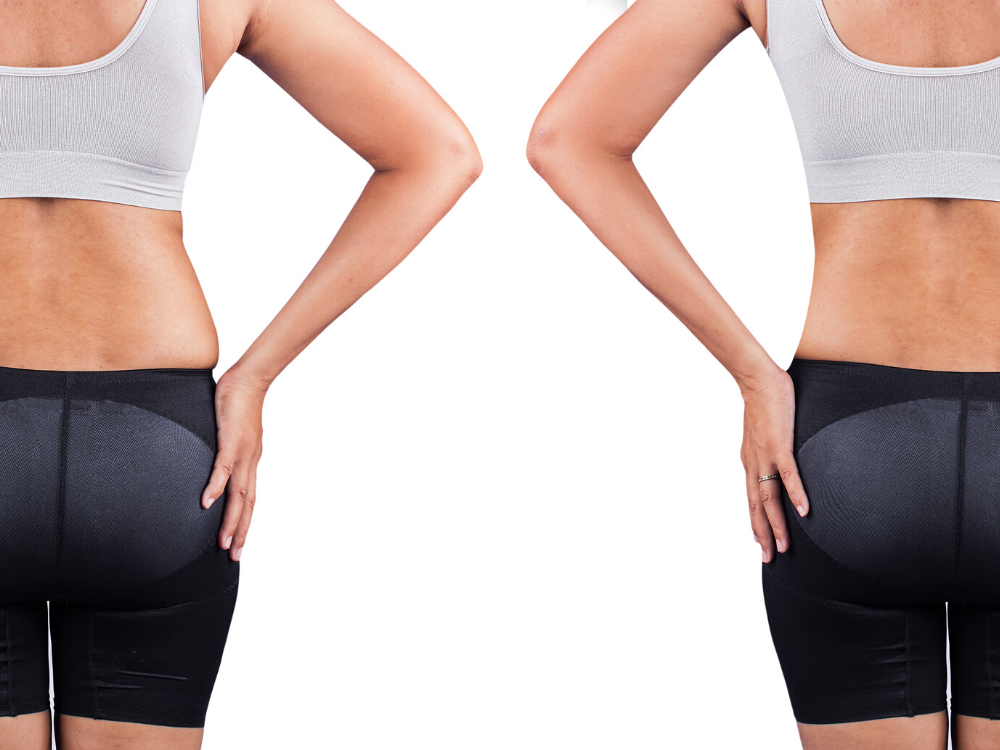 sono bello vs. coolsculpting dc
