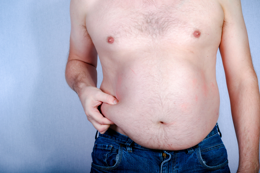 CoolSculpting for Mens Love Handles in Alexandria