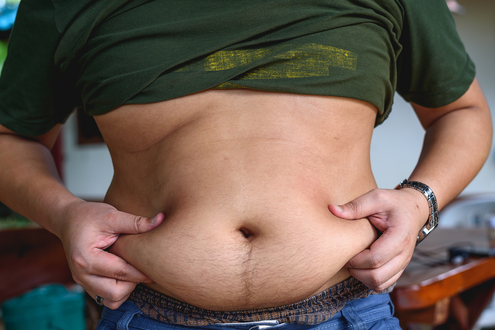 Why You Should Use CoolSculpting for Men's Belly Fat in Arlington