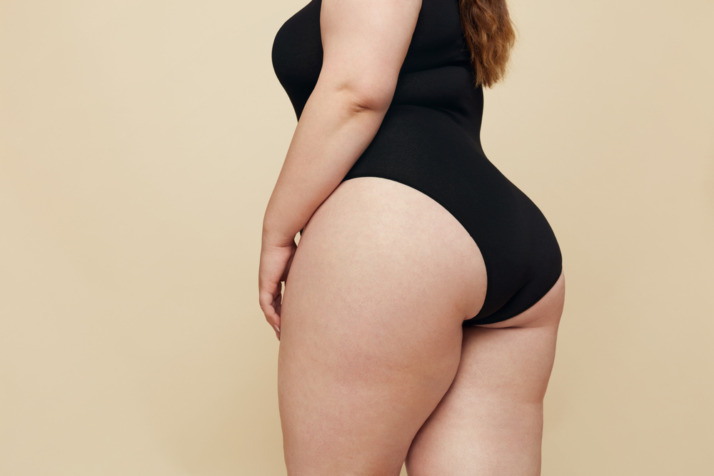 Rosslyn VA CoolSculpting