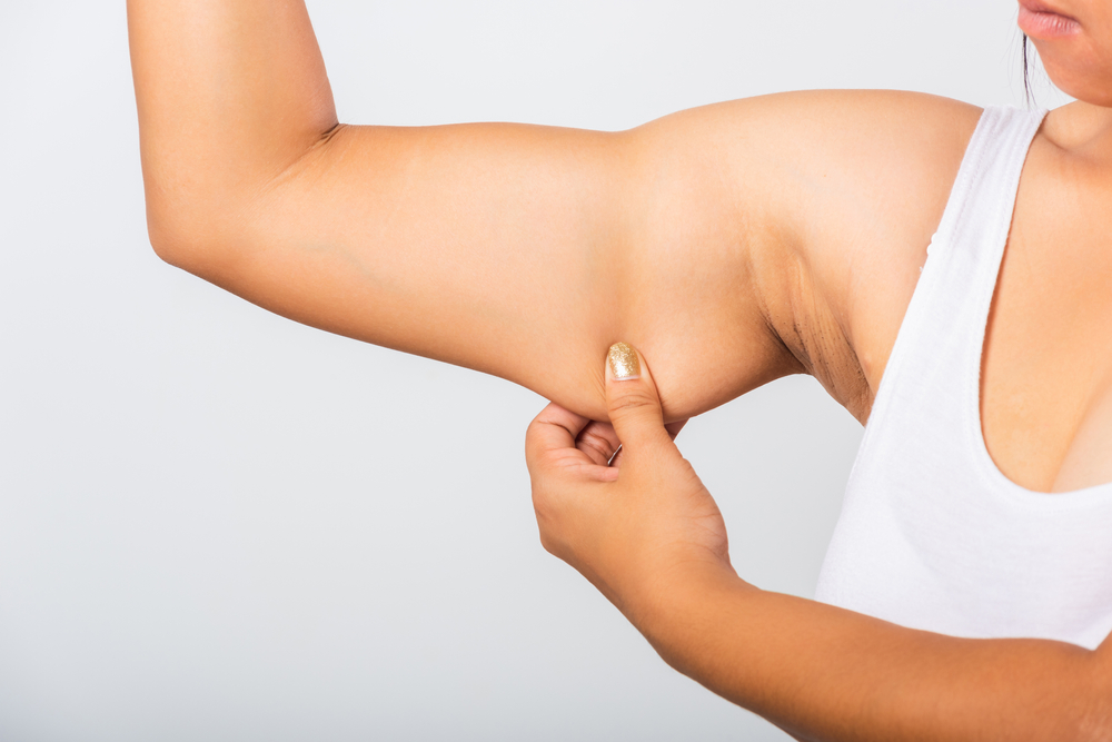 Under Arm CoolSculpting