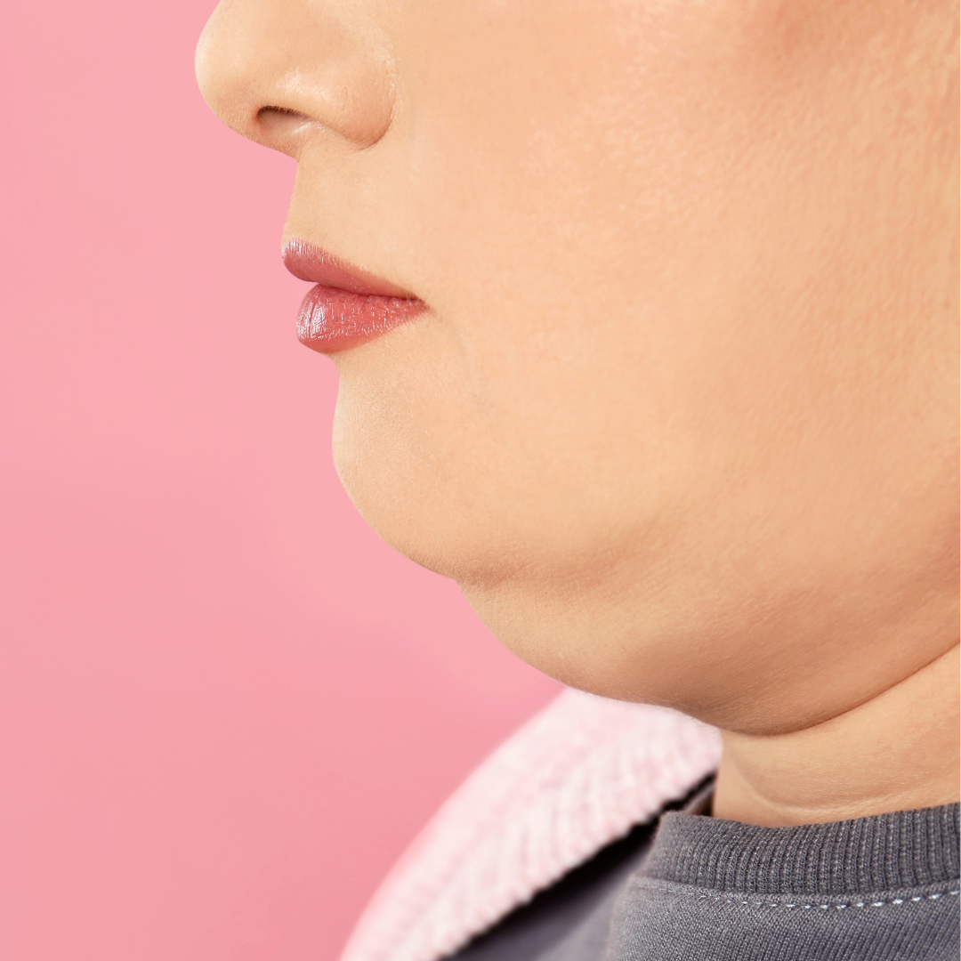 Best CoolSculpting for Double Chin Cost in Virginia
