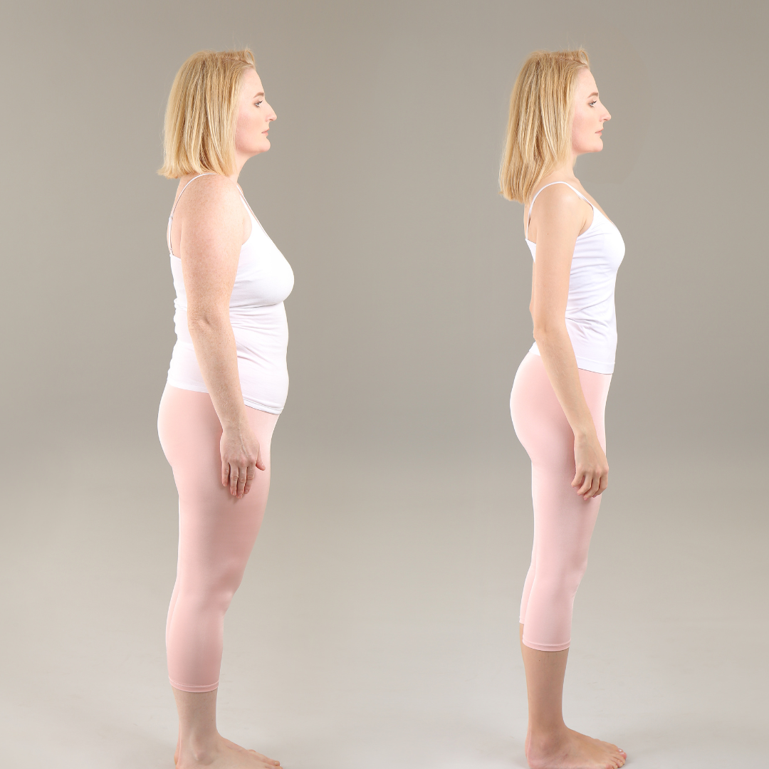 Mounjaro and CoolSculpting in Fairfax, VA