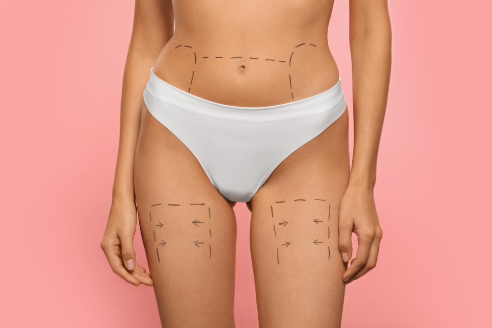 CoolSculpting Prices in DC