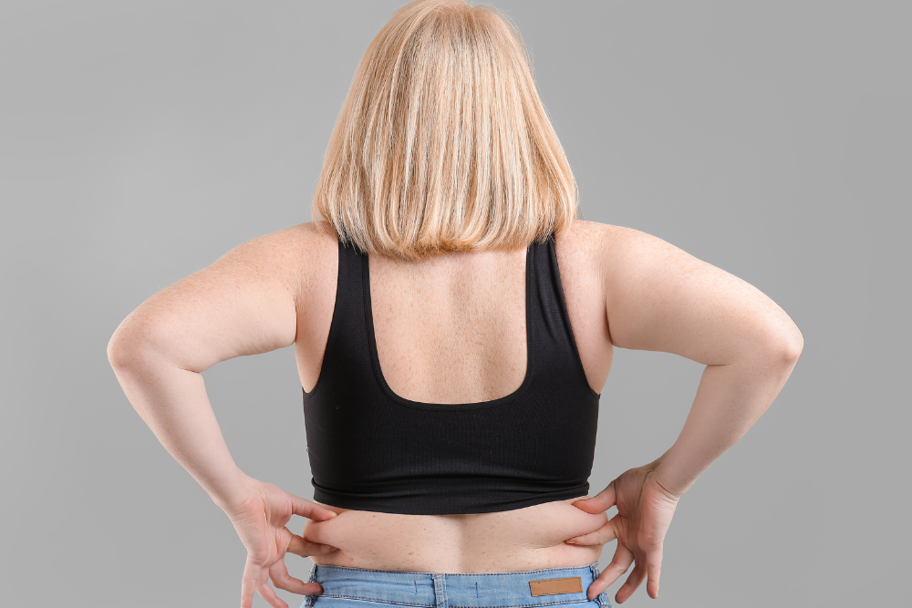 Why Vienna, VA Residents Are Choosing CoolSculpting for Stubborn Fat