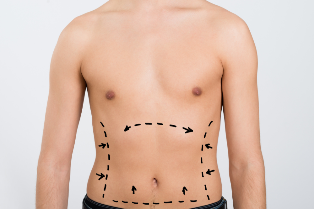 Breaking Down CoolSculpting Prices in Alexandria, Virginia