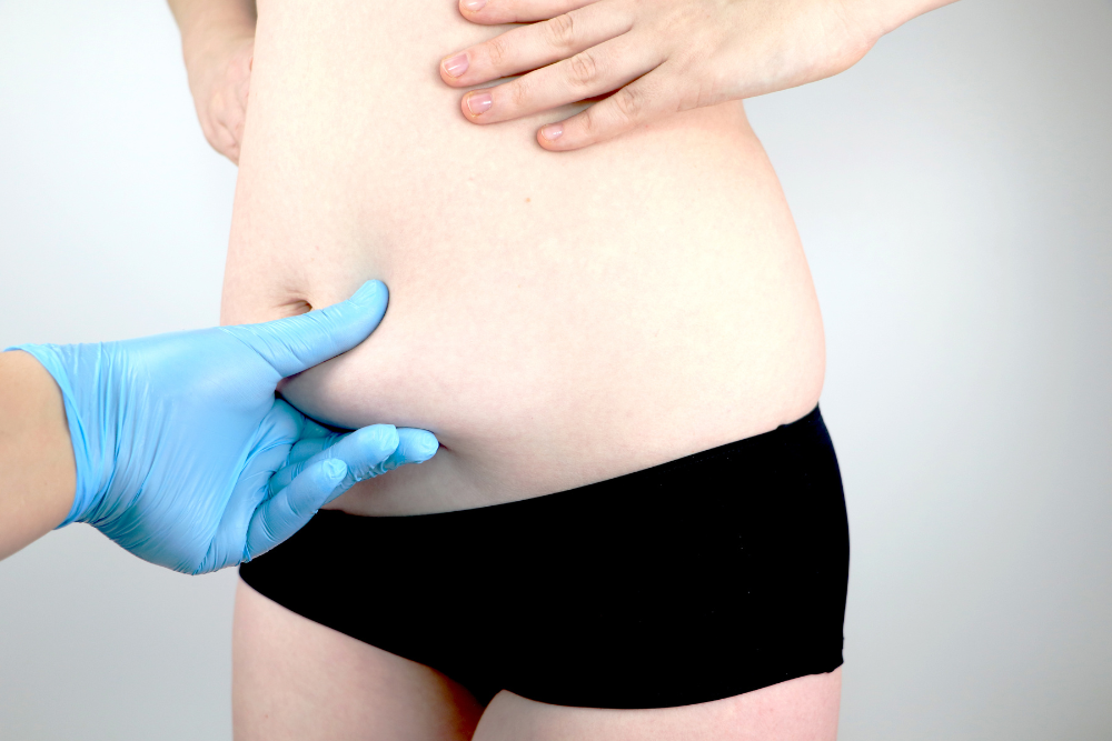 Free CoolSculpting Appointments in Arlington’s Most Exclusive Neighborhoods