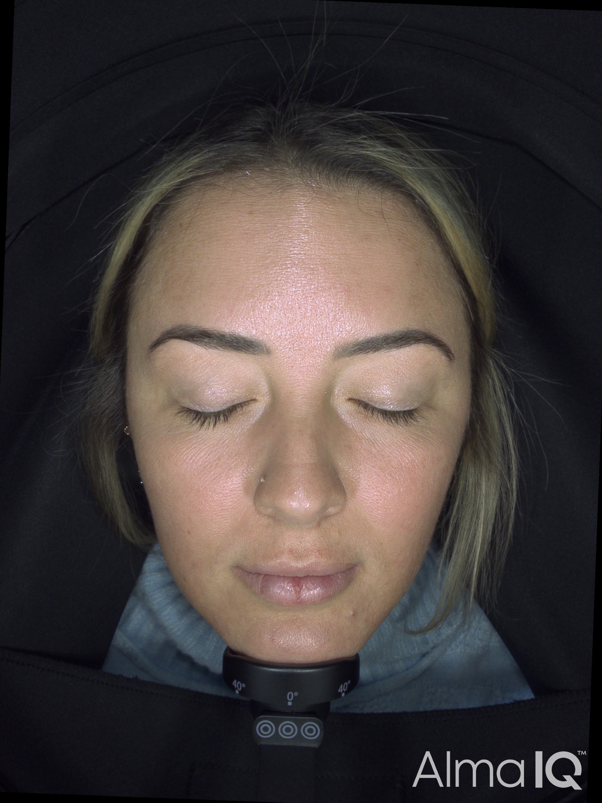 Molli Before Texture