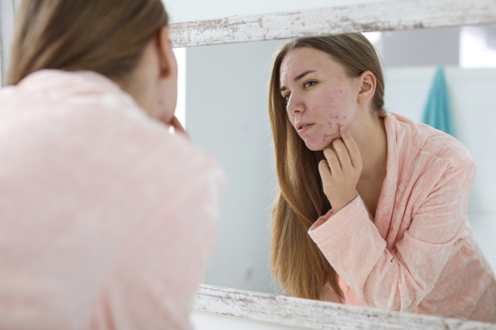 Acne Specialist Potomac MD