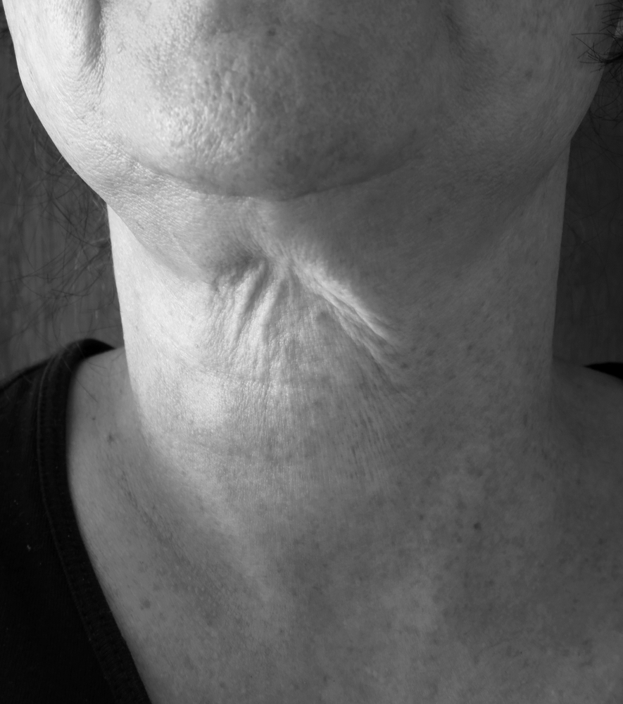 Neck Tightening Treatments in Potomac