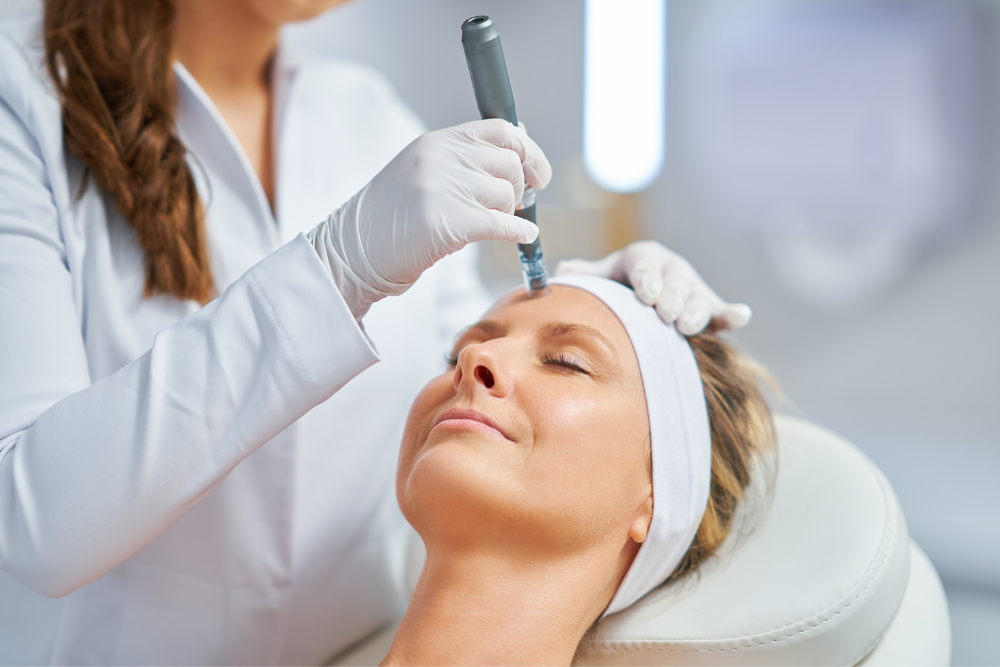 Microneedling in Potomac Maryland